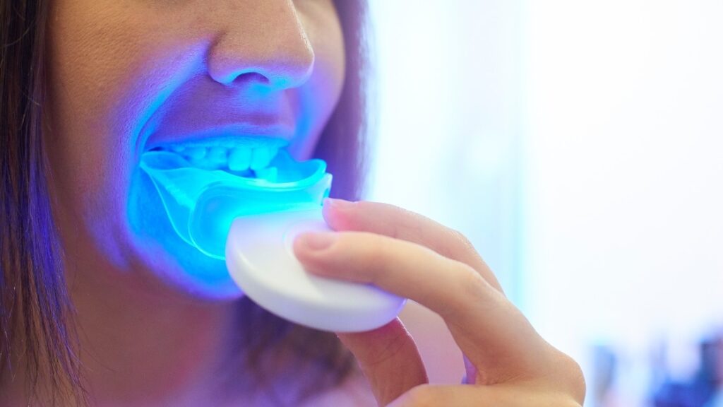 Teeth bleaching and whitening safety