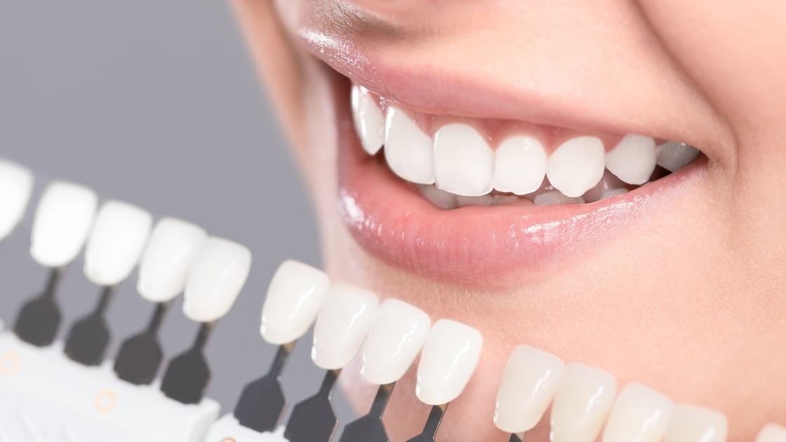 Is Having White Teeth Healthy? The Truth Behind Dental Myths